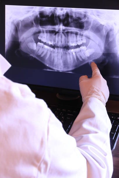Best Emergency Tooth Extraction in St Marys, OH
