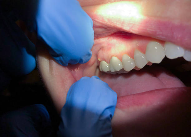 Best Emergency TMJ Treatment in St Marys, OH