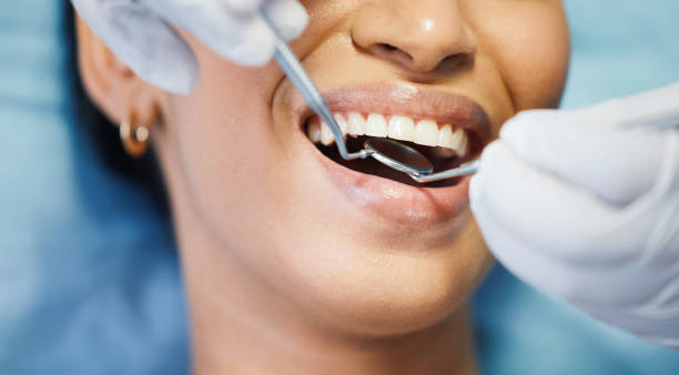 Best Emergency Gum Treatment in St Marys, OH