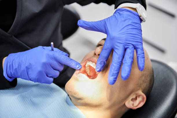 Best Emergency Dental Care for Broken or Chipped Teeth in St Marys, OH