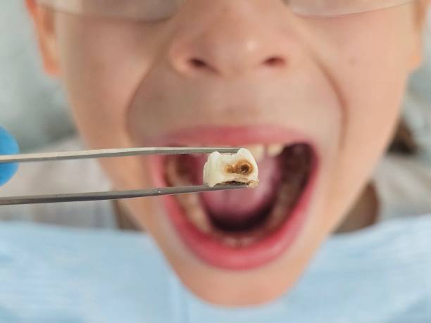 Best Emergency TMJ Treatment in St Marys, OH