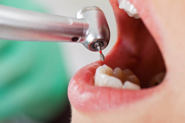 Best Pediatric Emergency Dentist in St Marys, OH